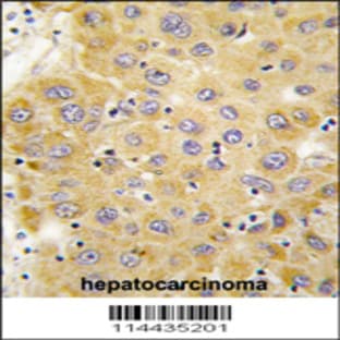 anti-Connective Tissue Growth Factor (CTGF) (C-Term), (AA 315-349) antibody avatar