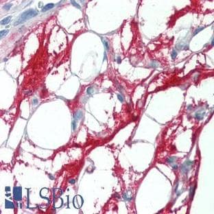 anti-Connective Tissue Growth Factor (CTGF) (C-Term) antibody avatar