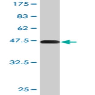 anti-Connective Tissue Growth Factor (CTGF) (AA 31-251) antibody avatar