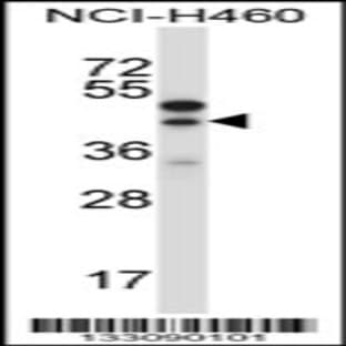 anti-Connective Tissue Growth Factor (CTGF) (AA 166-193), (Center) antibody avatar