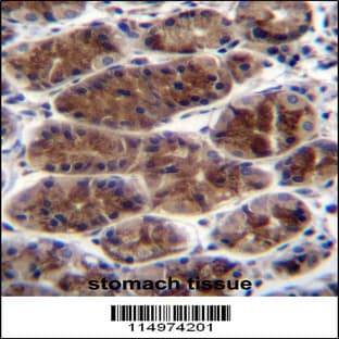 anti-Connective Tissue Growth Factor (CTGF) (AA 134-159), (Center) antibody avatar