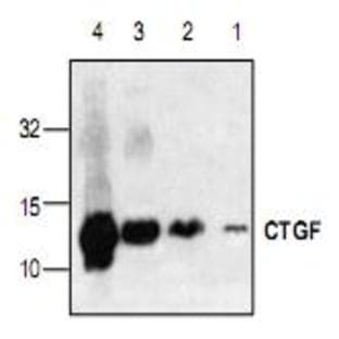 anti-Connective Tissue Growth Factor (CTGF) antibody avatar