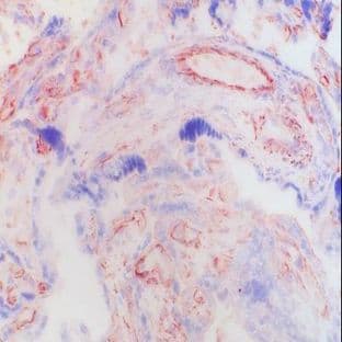 anti-Connective Tissue Growth Factor (CTGF) antibody avatar