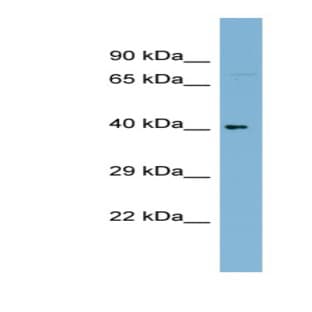 anti-Chromosome 10 Open Reading Frame 92 (C1ORF92) (Middle Region) antibody avatar