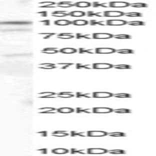 anti-Catenin (Cadherin-Associated Protein), alpha 1, 102kDa (CTNNA1) (Internal Region) antibody avatar