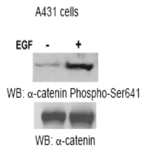 anti-Catenin (Cadherin-Associated Protein), alpha 1, 102kDa (CTNNA1) (Ser641) antibody avatar