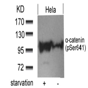 anti-Catenin (Cadherin-Associated Protein), alpha 1, 102kDa (CTNNA1) (pSer641) antibody avatar