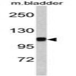 anti-Catenin (Cadherin-Associated Protein), alpha 1, 102kDa (CTNNA1) (N-Term) antibody avatar