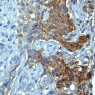 anti-Catenin (Cadherin-Associated Protein), alpha 1, 102kDa (CTNNA1) (N-Term) antibody avatar