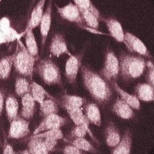 anti-Catenin (Cadherin-Associated Protein), alpha 1, 102kDa (CTNNA1) (AA 729-906) antibody avatar