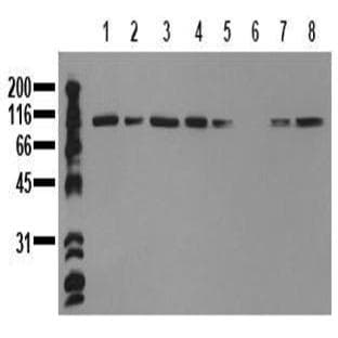 anti-Catenin (Cadherin-Associated Protein), alpha 1, 102kDa (CTNNA1) antibody avatar