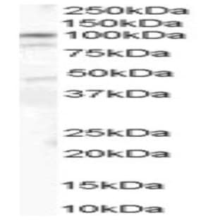 anti-Catenin (Cadherin-Associated Protein), alpha 1, 102kDa (CTNNA1) (Internal Region) antibody avatar