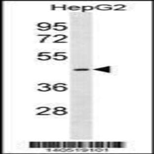 anti-Cystinosis, Nephropathic (CTNS) (C-Term), (AA 341-367) antibody avatar