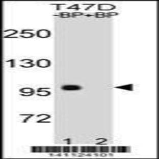 anti-Catenin (Cadherin-Associated Protein), beta 1, 88kDa (CTNNB1) (C-Term), (AA 692-721) antibody avatar