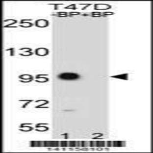 anti-Catenin (Cadherin-Associated Protein), beta 1, 88kDa (CTNNB1) (C-Term), (AA 723-751) antibody avatar