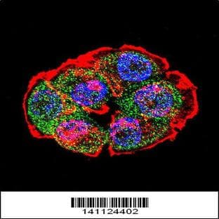 anti-Catenin (Cadherin-Associated Protein), beta 1, 88kDa (CTNNB1) (C-Term), (AA 692-721) antibody avatar
