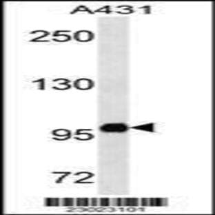 anti-Catenin (Cadherin-Associated Protein), beta 1, 88kDa (CTNNB1) (C-Term), (AA 692-721) antibody avatar
