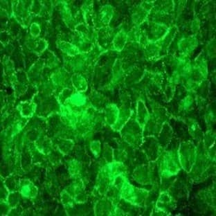 anti-Catenin (Cadherin-Associated Protein), beta 1, 88kDa (CTNNB1) (N-Term) antibody avatar