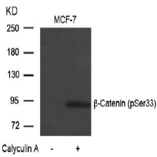 anti-Catenin (Cadherin-Associated Protein), beta 1, 88kDa (CTNNB1) (pSer33) antibody avatar