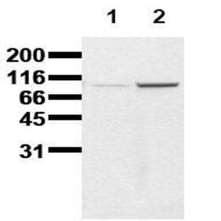 anti-Catenin (Cadherin-Associated Protein), beta 1, 88kDa (CTNNB1) (pTyr86) antibody avatar