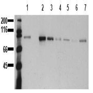 anti-Catenin (Cadherin-Associated Protein), beta 1, 88kDa (CTNNB1) (AA 27-37) antibody avatar