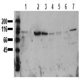 anti-Catenin (Cadherin-Associated Protein), beta 1, 88kDa (CTNNB1) (AA 35-50) antibody avatar