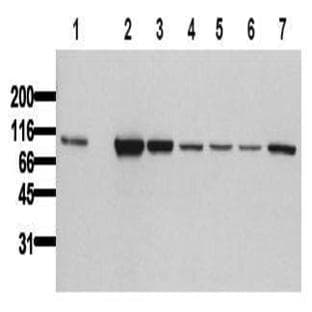 anti-Catenin (Cadherin-Associated Protein), beta 1, 88kDa (CTNNB1) (N-Term), (Exon 2) antibody avatar