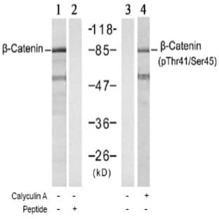 anti-Catenin (Cadherin-Associated Protein), beta 1, 88kDa (CTNNB1) (Thr41), (Ser45) antibody avatar