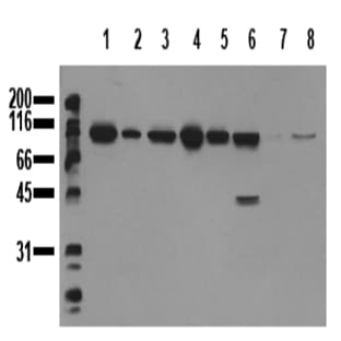 anti-Catenin (Cadherin-Associated Protein), beta 1, 88kDa (CTNNB1) (Exon 3) antibody avatar