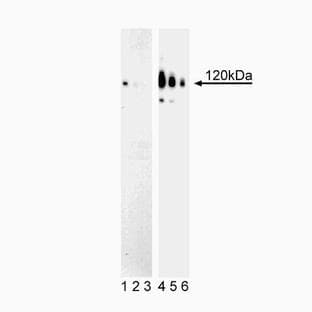 anti-Catenin (Cadherin-Associated Protein), delta 1 (CTNND1) (pThr310) antibody avatar