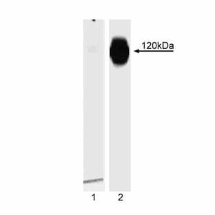 anti-Catenin (Cadherin-Associated Protein), delta 1 (CTNND1) (pSer288) antibody avatar