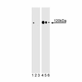 anti-Catenin (Cadherin-Associated Protein), delta 1 (CTNND1) (pThr916) antibody avatar