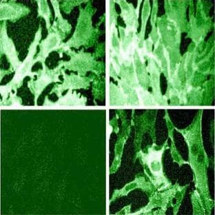 anti-Catenin (Cadherin-Associated Protein), delta 1 (CTNND1) (AA 1-911), (pTyr280) antibody avatar