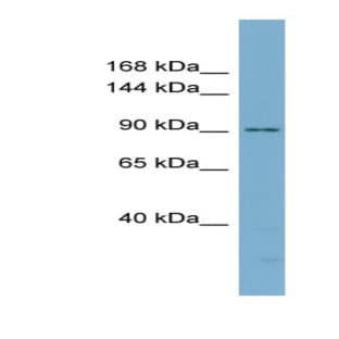 anti-Catenin (Cadherin-Associated Protein), delta 1 (CTNND1) (N-Term) antibody avatar