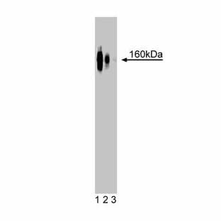 anti-Catenin (Cadherin-Associated Protein), delta 2 (Neural Plakophilin-Related Arm-Repeat Protein (CTNND2) (AA 85-194) antibody avatar