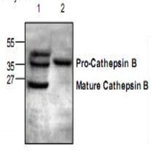 anti-Cathepsin B (CTSB) antibody avatar