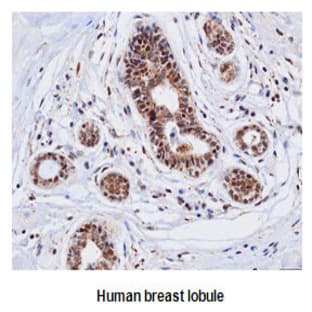 anti-Cathepsin D (CTSD) (AA 21-412) antibody avatar