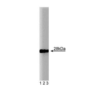 anti-Cathepsin D (CTSD) antibody avatar