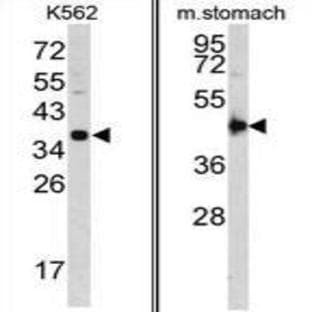 anti-Cathepsin E (CTSE) (Middle Region) antibody avatar