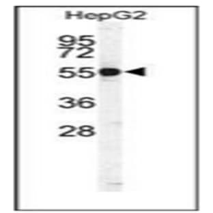 anti-Cathepsin H (CTSH) (N-Term), (AA 32-62) antibody avatar