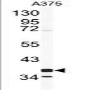 anti-Cathepsin K (CTSK) (Middle Region) antibody avatar