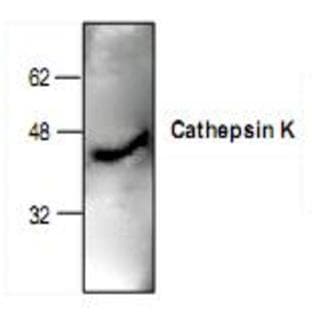 anti-Cathepsin K (CTSK) antibody avatar