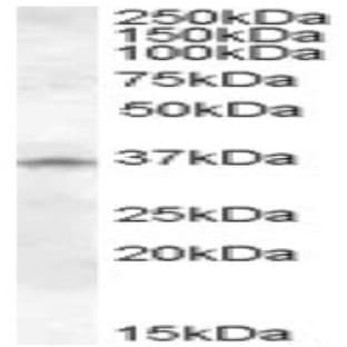 anti-Cathepsin K (CTSK) (Internal Region) antibody avatar