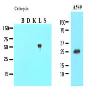 anti-Cathepsin L1 (CTSL1) (AA 114-333) antibody avatar