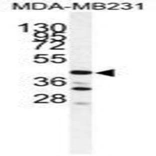 anti-Cathepsin S (CTSS) (Middle Region) antibody avatar