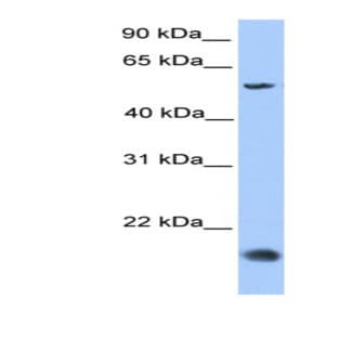 anti-CKLF-Like MARVEL Transmembrane Domain Containing 8 (CMTM8) (Middle Region) antibody avatar