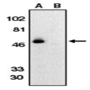 anti-Chemokine (C-X3-C Motif) Receptor 1 (CX3CR1) (AA 175-189) antibody avatar