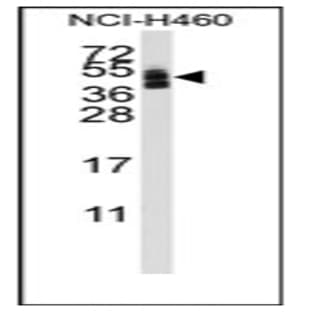 anti-Coxsackie Virus and Adenovirus Receptor (CXADR) (AA 140-169), (Middle Region) antibody avatar