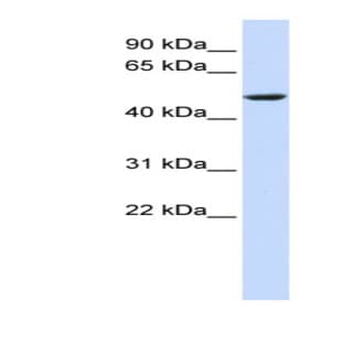 anti-Cytochrome B-561 (CYB561) (Middle Region) antibody avatar