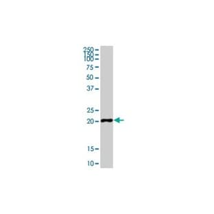 anti-Cytochrome B-245, alpha Polypeptide (CYBA) (Light Chain) antibody avatar